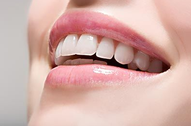 Consejos para blanquear tus dientes