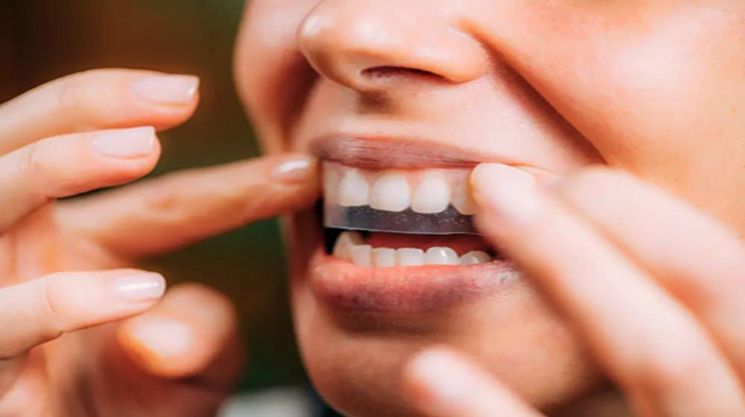 ¿Puedo comer después de usar las tiras blanqueadoras de dientes Onuge?